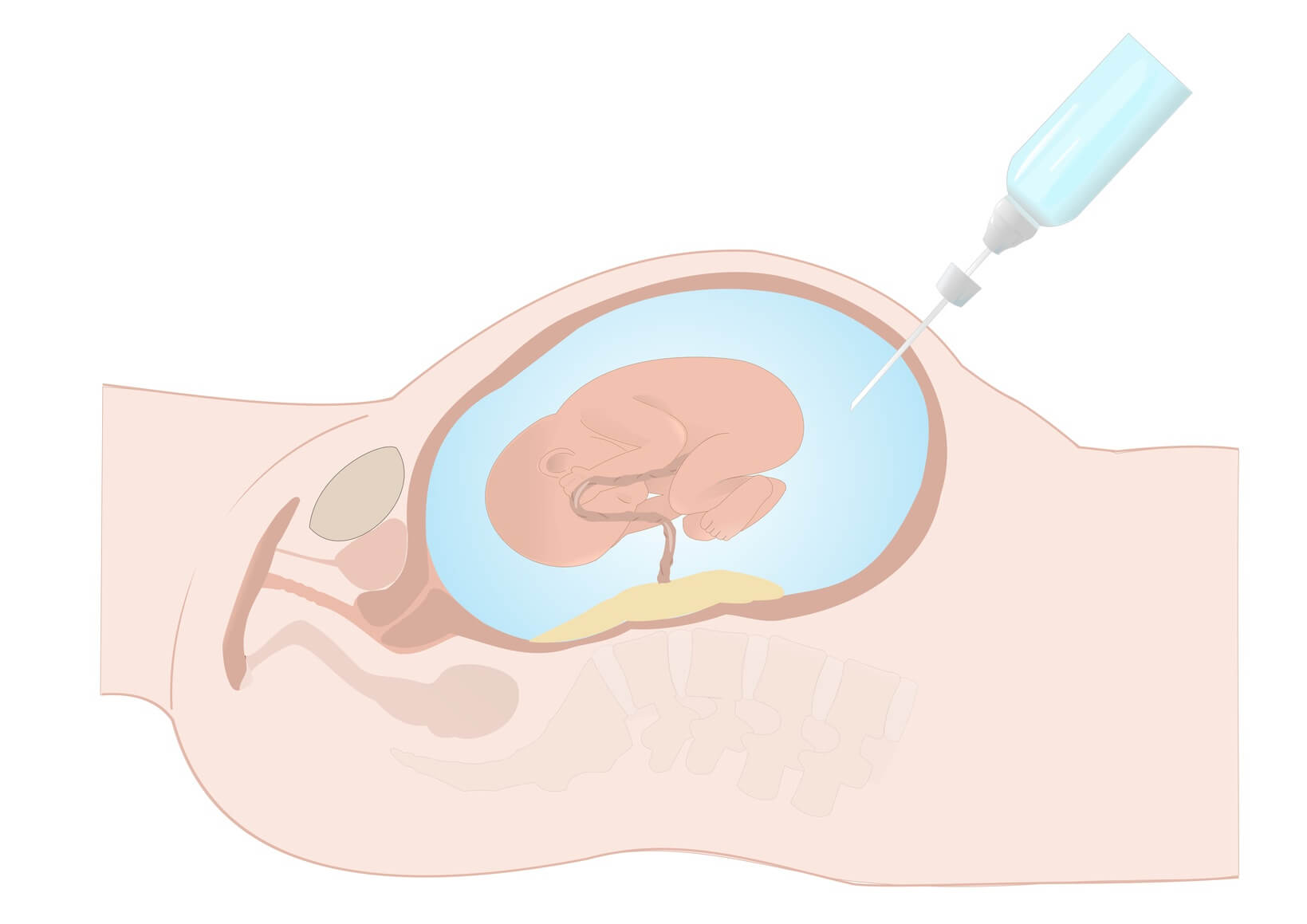 Akraba Evliliğinde Hasta Çocuk Olması Nasıl Önlenir?