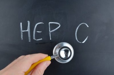 Hepatit C