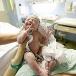 Doğum Travmasında Organ Yaralanmaları