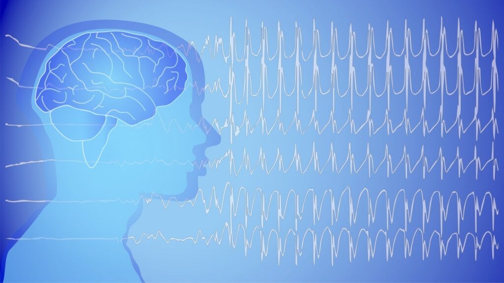 Epilepsi Hakkında Merak Ettikleriniz