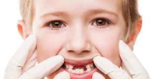 Okul Öncesi Dönemde Diş Sağlığı