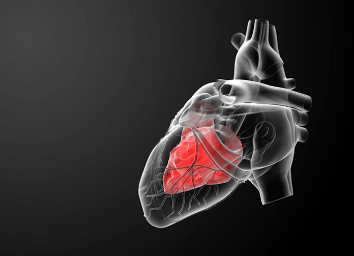 ASD (Atrial Septal Defekt)