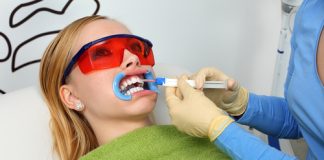 Diş Beyazlatma Yöntemleri