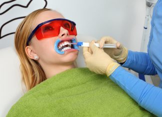 Diş Beyazlatma Yöntemleri