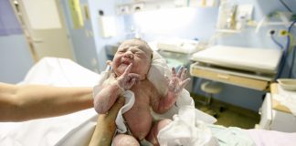 Doğum Travmaları ve Nedenleri