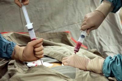 Lösemi Tedavisinde Kemik İliği Nakli
