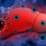 Liver Infection with hepatitis viruses