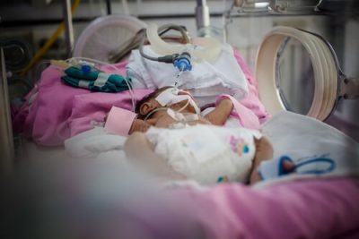 Prematüre Bebekleri Bekleyen Sorunlar