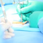 kasık fıtığı-bazı ameliyatlar – cerrahi – safra – ercp vs